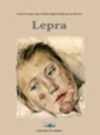 "Leprosy" av Lorentz M. Irgens